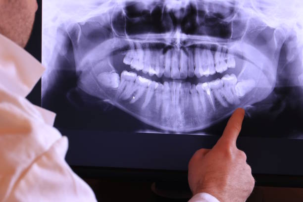 Best Emergency Cosmetic Dentistry (e.g., broken veneers) in Succasunna, NJ