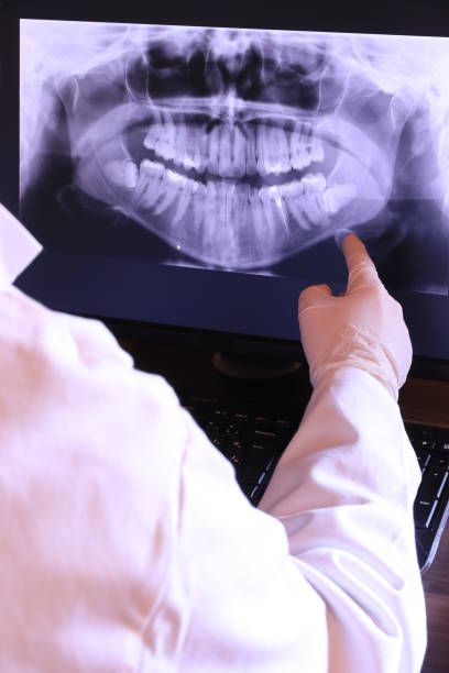 Best Emergency Root Canal Therapy in Succasunna, NJ